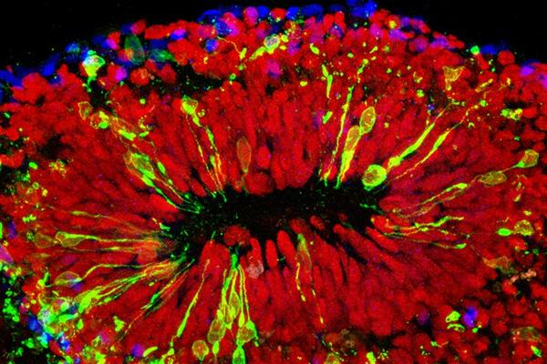 科學家攻克Zika病毒 高中生攜3D打印來幫忙

Zika病毒,3D打印醫(yī)療行業(yè),3D打印材料價格,3D打印技術(shù),3D打印材料,3D打印成本,3D打印價格