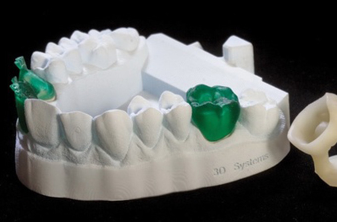 德國率先引入3D打印牙齒技術(shù) 全程體驗“無痛”種牙-e鍵打印|3D打印服務
3d打印牙齒,3D打印種牙,無痛種牙,3D打印平臺,3D打印服務,南京哪里有3D打印,南京3D打印廠家,南京3D打印服務