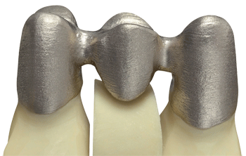 德國率先引入3D打印牙齒技術(shù) 全程體驗“無痛”種牙-e鍵打印|3D打印服務
3d打印牙齒,3D打印種牙,無痛種牙,3D打印平臺,3D打印服務,南京哪里有3D打印,南京3D打印廠家,南京3D打印服務