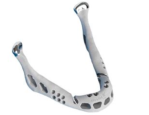 3d打印下頜骨成功移植 置換人體器官不再是夢(mèng)-e鍵打印|3D打印服務(wù)
醫(yī)療3d打印技術(shù),3D打印下頜骨,3D打印人體器官,3D打印器官,3D打印心臟,3D打印假肢,3D打印大腦,3D打印技術(shù),3D打印服務(wù),3D打印云平臺(tái)