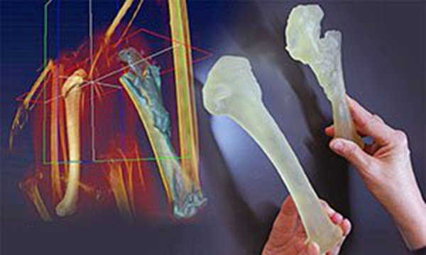 左邊是雄鷹健康的肱骨，右邊是雄鷹實際受傷的骨頭的復(fù)制品