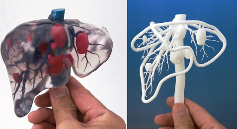 個(gè)性化醫(yī)療3D打印實(shí)戰(zhàn)案例與研究成果的問答整理_3d打印服務(wù)公司