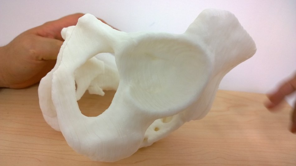 3d打印應(yīng)用領(lǐng)域之醫(yī)療應(yīng)用_e鍵打印服務(wù)公司