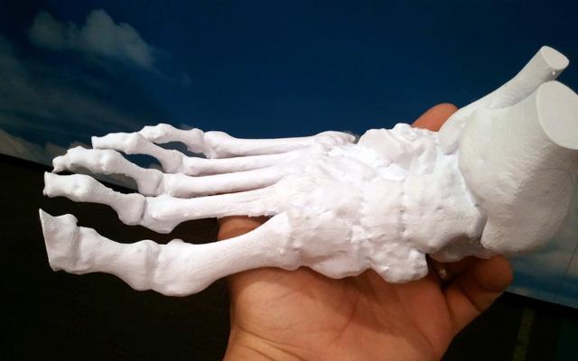 3d打印應(yīng)用領(lǐng)域之醫(yī)療應(yīng)用_e鍵打印服務(wù)公司