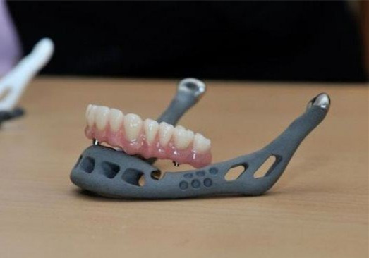 醫(yī)療3D打印的假牙 新手選擇3D打印手板模型加工打樣還是CNC加工?選擇當(dāng)?shù)剡€是全國(guó)3D打印公司?