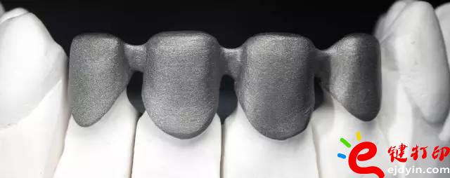 醫(yī)療輔助器械的變革之路 3d打印義齒(假牙)前景無限 勢在必行_醫(yī)療設(shè)備器械3d模型打印平臺