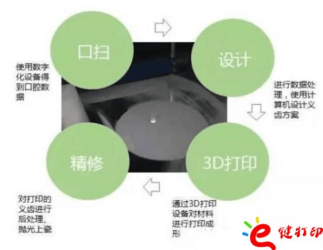 醫(yī)療輔助器械的變革之路 3d打印義齒(假牙)前景無限 勢在必行_醫(yī)療設(shè)備器械3d模型打印平臺