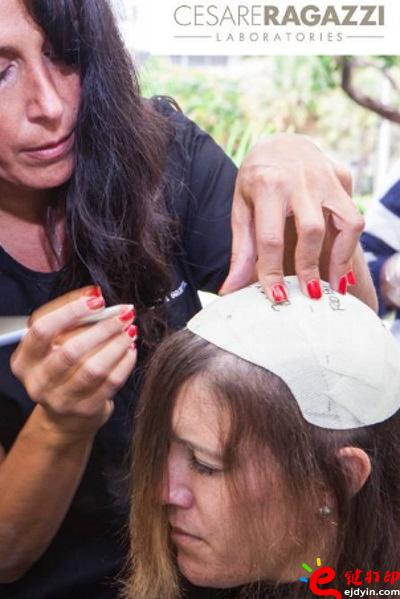 另類治療脫發(fā)的最好方法 用3D打印超逼真假發(fā)解決困擾 治療脫發(fā)不再煩,3d打印頭發(fā),假發(fā)3d模型,3d打印材料,3d打印服務(wù),3d打印廠家