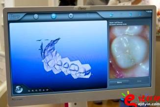 3d打印牙齒價格,3d打印牙齒模型,3d打印牙齒臨床了嗎,3d打印牙齒價格表,3d打印牙齒能用多久