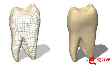 3d打印牙齒價格,3d打印牙齒模型,3d打印牙齒臨床了嗎,3d打印牙齒價格表,3d打印牙齒能用多久