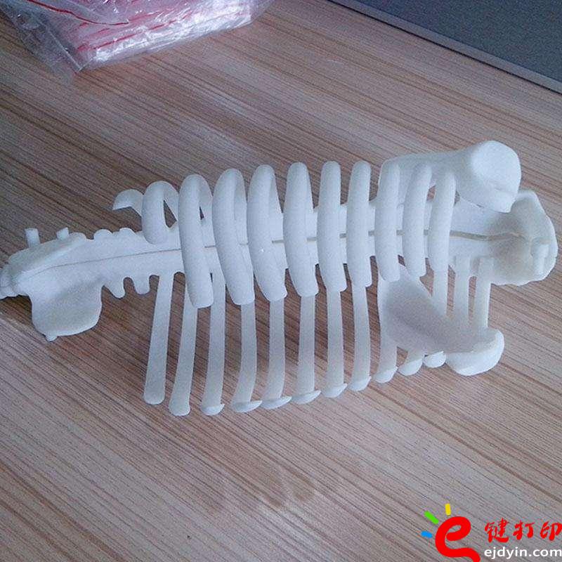醫(yī)療3D打印骨骼模型、3d打印定制手板,3d打印加工手板,3d打印手板模型,3d打印模型,深圳3d打印手板,3d打印手板工廠,工業(yè)級3d打印手板公司