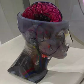 彩色3d打印人體器官醫(yī)學模型4